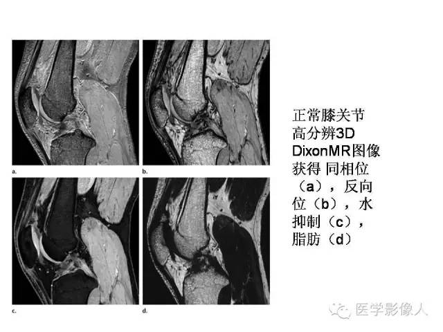 【PPT】肌骨系统MR成像脂肪抑制技术