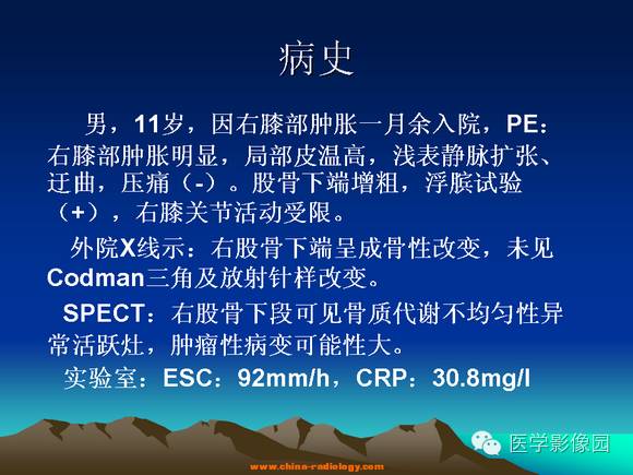 【病例】夏科氏关节1例X线及MR影像表现