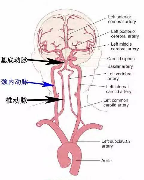 手把手教会阅读颅脑MRA和CTA
