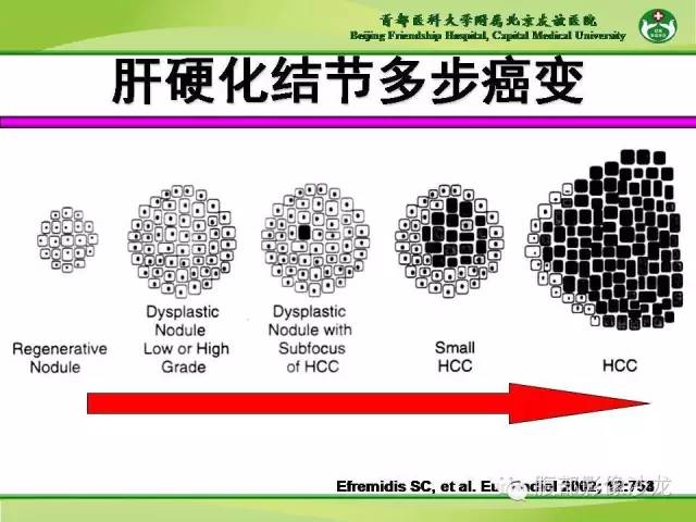 【PPT】肝脏影像报告与数据系统2014