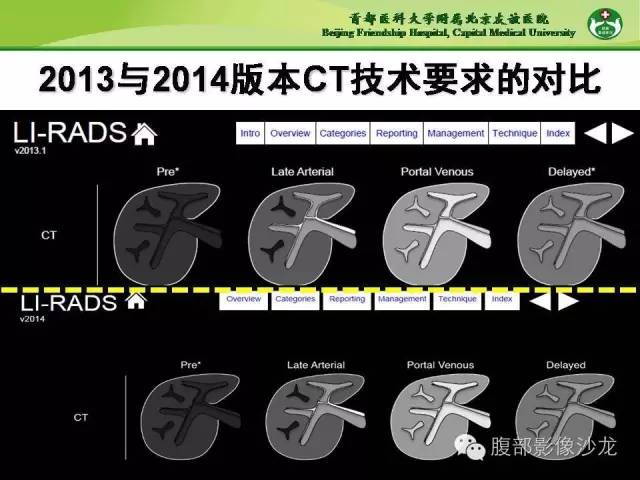 【PPT】肝脏影像报告与数据系统2014