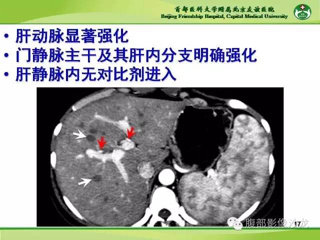 【PPT】肝脏影像报告与数据系统2014