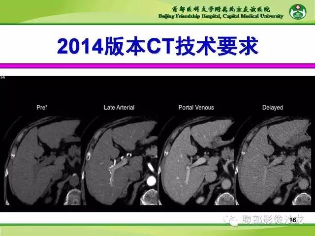 【PPT】肝脏影像报告与数据系统2014