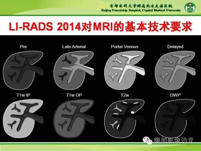 【PPT】肝脏影像报告与数据系统2014