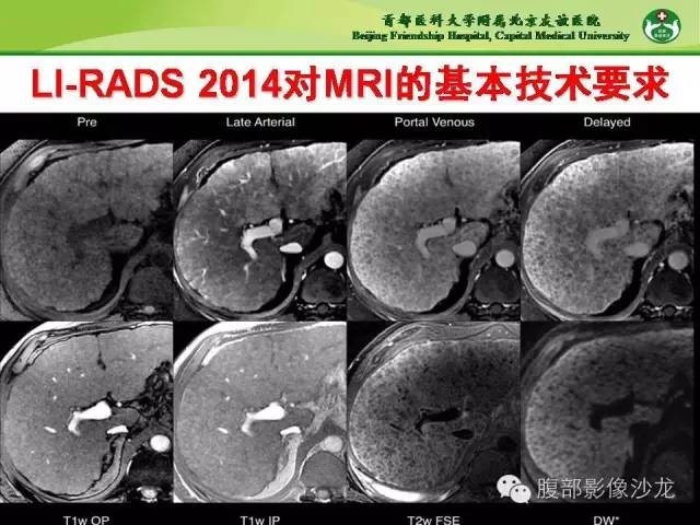 【PPT】肝脏影像报告与数据系统2014