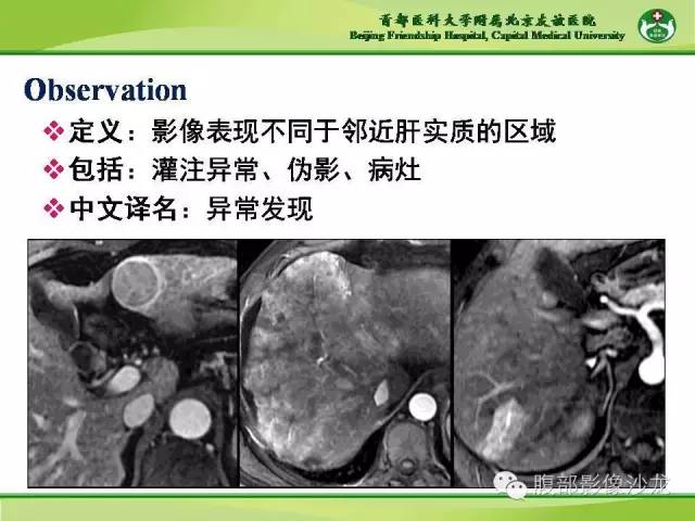 【PPT】肝脏影像报告与数据系统2014