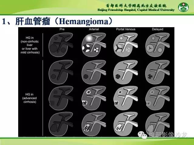 【PPT】肝脏影像报告与数据系统2014