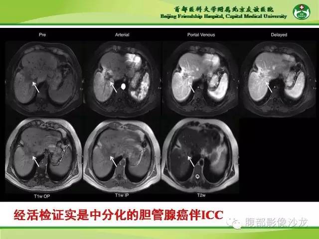 【PPT】肝脏影像报告与数据系统2014