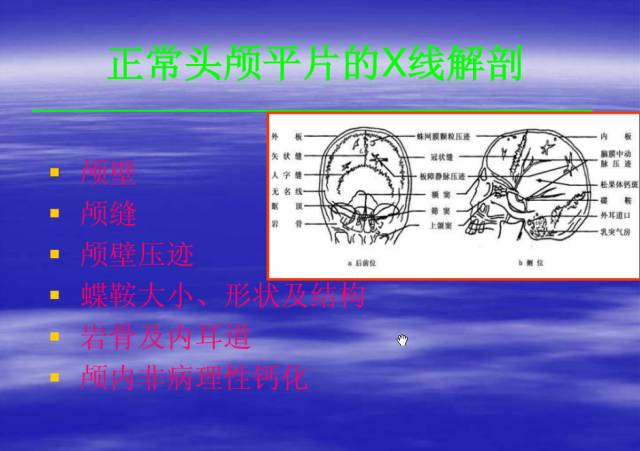 【PPT】中枢神经系统正常影像学表现