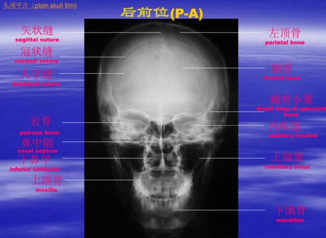 【PPT】中枢神经系统正常影像学表现