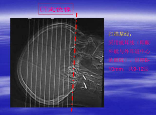 【PPT】中枢神经系统正常影像学表现