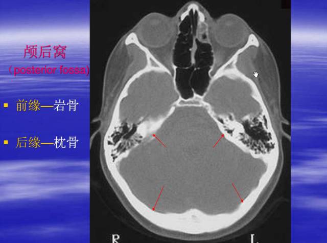 【PPT】中枢神经系统正常影像学表现