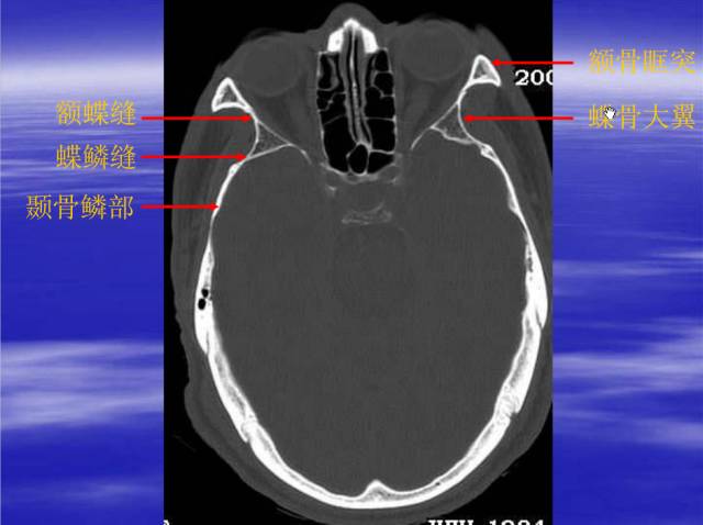 【PPT】中枢神经系统正常影像学表现