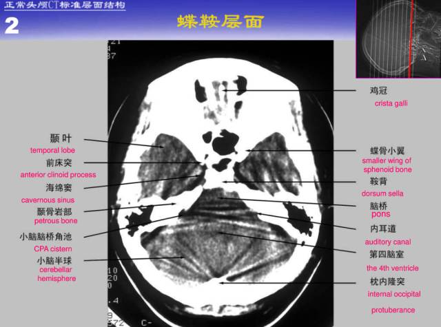 【PPT】中枢神经系统正常影像学表现