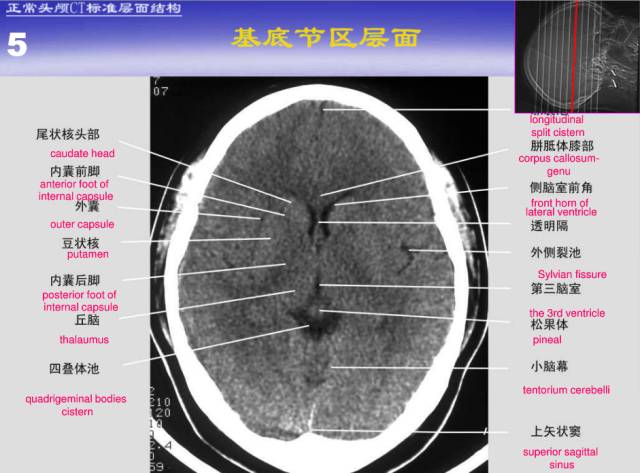 【PPT】中枢神经系统正常影像学表现