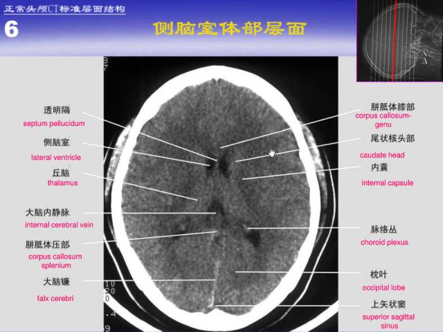【PPT】中枢神经系统正常影像学表现