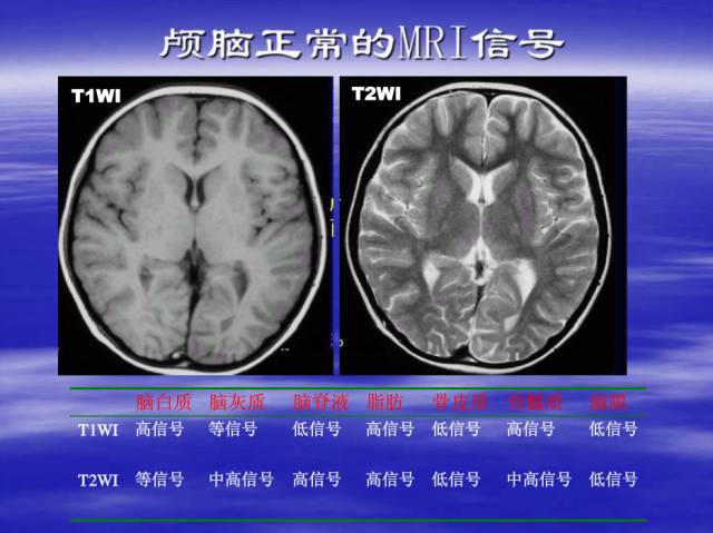 【PPT】中枢神经系统正常影像学表现
