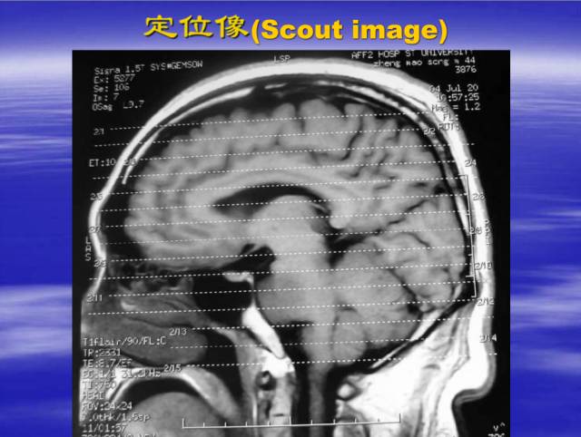 【PPT】中枢神经系统正常影像学表现