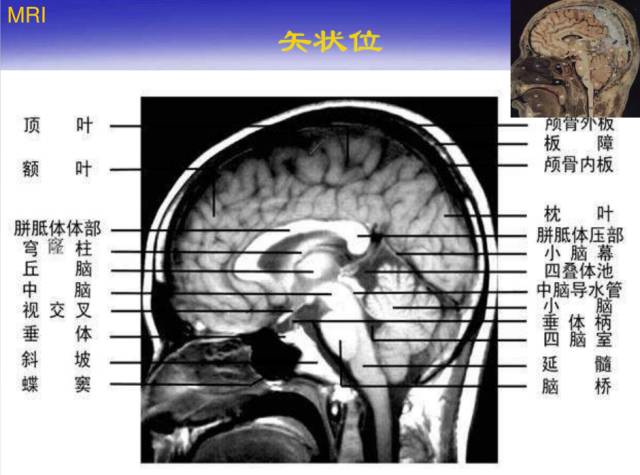 【PPT】中枢神经系统正常影像学表现