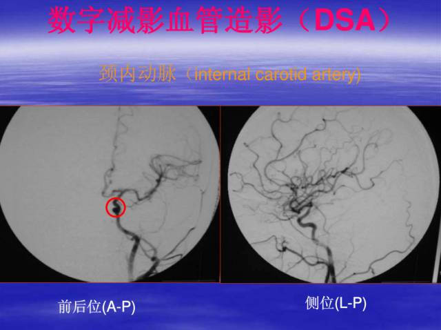 【PPT】中枢神经系统正常影像学表现