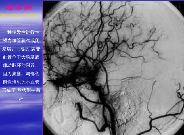 【PPT】中枢神经系统正常影像学表现