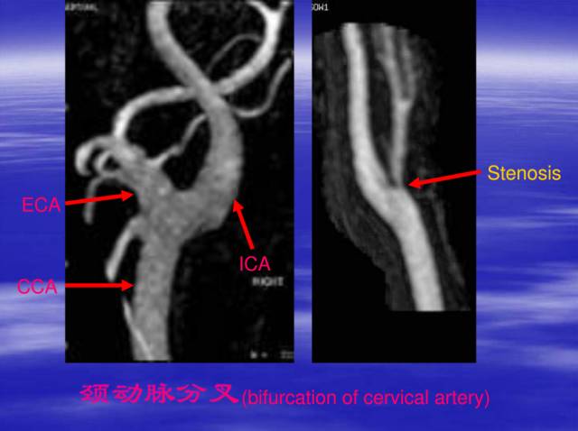 【PPT】中枢神经系统正常影像学表现