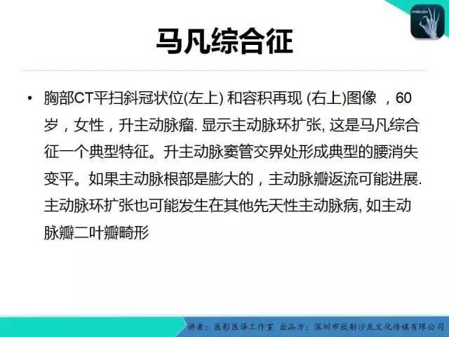 【PPT】普通放射科医生需要了解的成人心脏瓣膜病知识