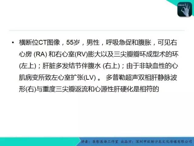 【PPT】普通放射科医生需要了解的成人心脏瓣膜病知识