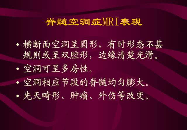 【PPT】脊髓空洞症影像表现
