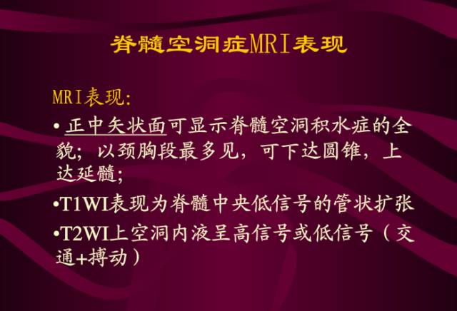 【PPT】脊髓空洞症影像表现