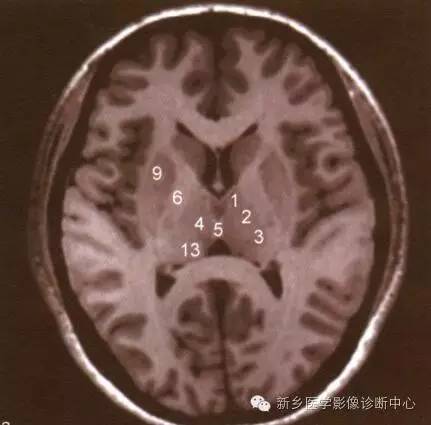 深刻了解丘脑解剖和血供