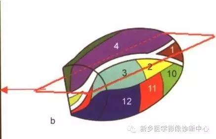 深刻了解丘脑解剖和血供 深刻了解丘脑解剖和血供