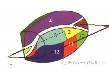 深刻了解丘脑解剖和血供 深刻了解丘脑解剖和血供
