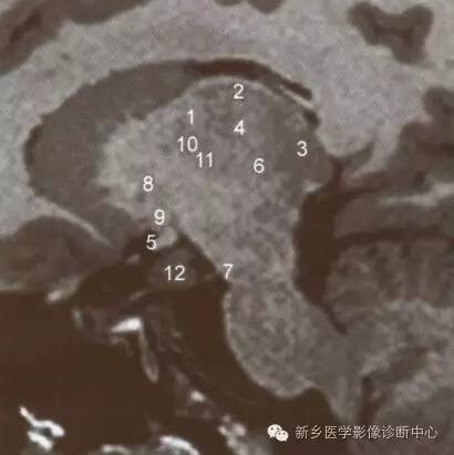深刻了解丘脑解剖和血供 深刻了解丘脑解剖和血供