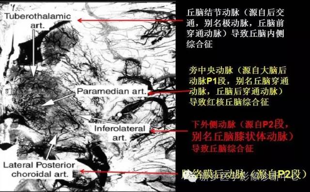 深刻了解丘脑解剖和血供 深刻了解丘脑解剖和血供