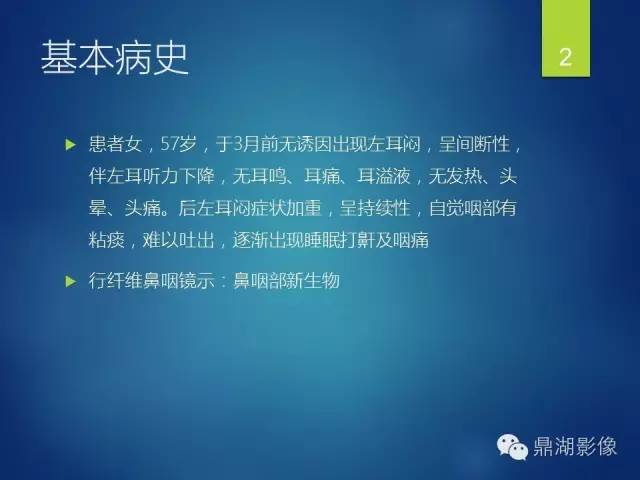【病例】鼻咽淋巴瘤 1例CT影像表现