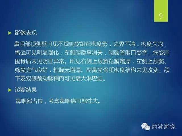 【病例】鼻咽淋巴瘤 1例CT影像表现 【病例】鼻咽淋巴瘤 1例CT影像表现