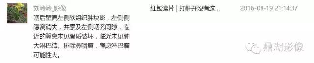【病例】鼻咽淋巴瘤 1例CT影像表现 【病例】鼻咽淋巴瘤 1例CT影像表现