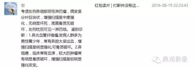 【病例】鼻咽淋巴瘤 1例CT影像表现 【病例】鼻咽淋巴瘤 1例CT影像表现
