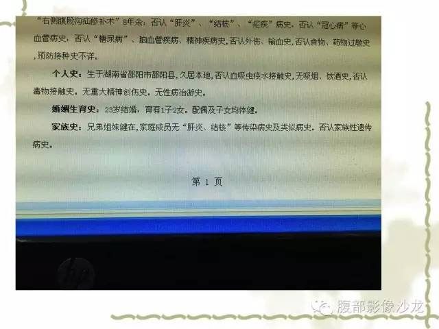【病例】十二指肠间质瘤1例CT影像表现 【病例】十二指肠间质瘤1例CT影像表现