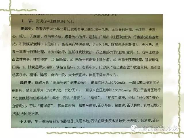 【病例】十二指肠间质瘤1例CT影像表现 【病例】十二指肠间质瘤1例CT影像表现