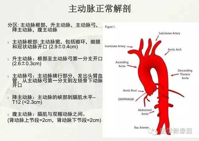 【PPT】大血管疾病的MR诊断