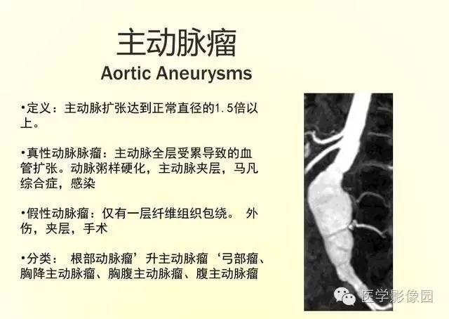 【PPT】大血管疾病的MR诊断