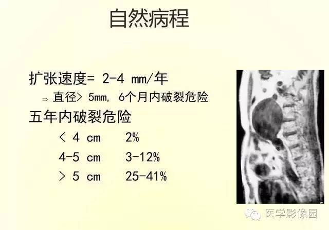 【PPT】大血管疾病的MR诊断
