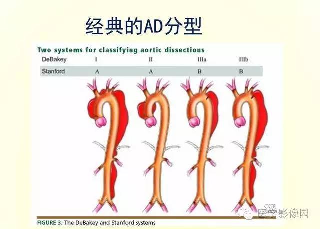 【PPT】大血管疾病的MR诊断