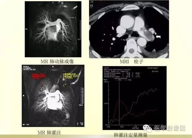 【PPT】大血管疾病的MR诊断