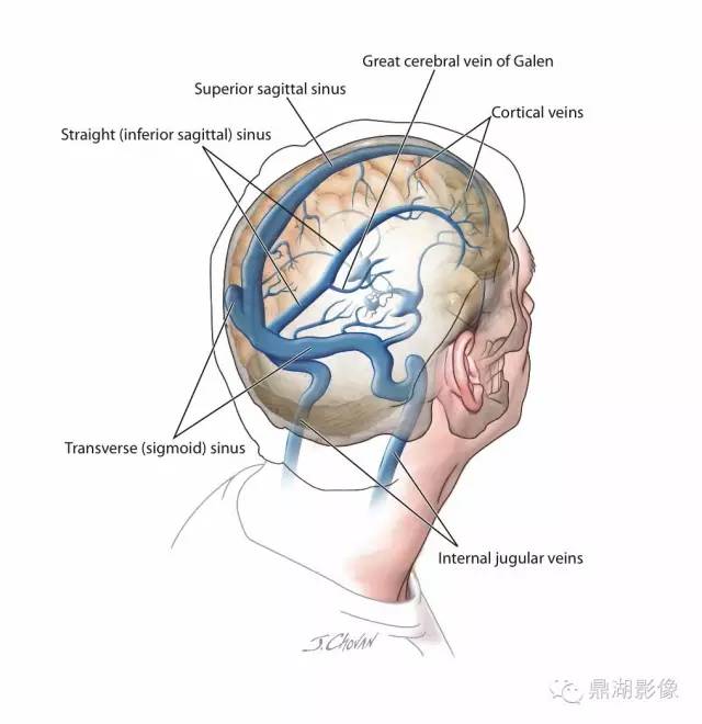 高清头颅静脉系统解剖 高清头颅静脉系统解剖