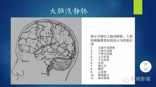 高清头颅静脉系统解剖