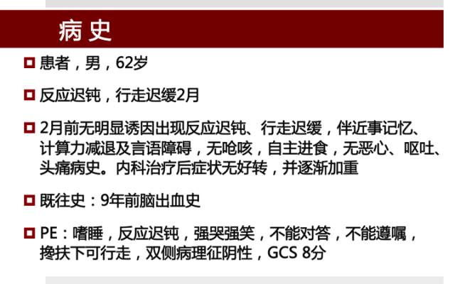 【病例】硬脑膜动静脉瘘1例