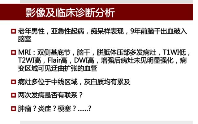 【病例】硬脑膜动静脉瘘1例